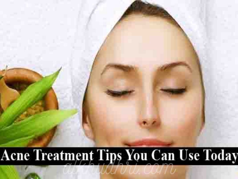 5 Acne Treatment Tips